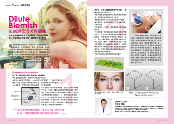 痘疤焕化成美丽蝴蝶(图1)