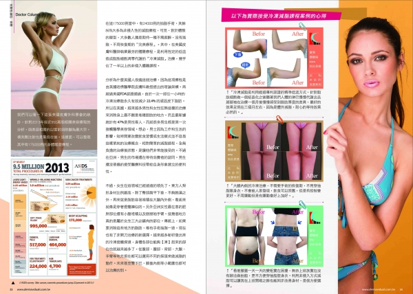快退出「腹愁者联盟」“酷塑”冷冻减脂 肥肉赘肉扫光光(图2)