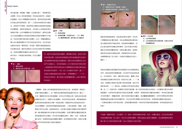 脸上斑点知多少 ?(图2)
